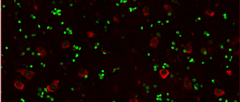this is an image of cells that are positive for kcnh7 taken via 20x microscope