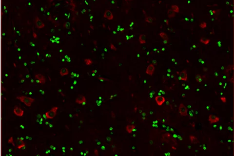 this is an image of cells that are positive for kcnh7 taken via 20x microscope