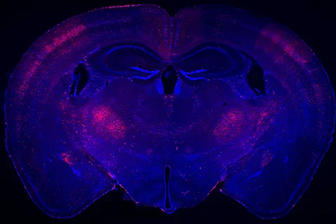 coronal section from a mouse brain labeled with red fluorescence