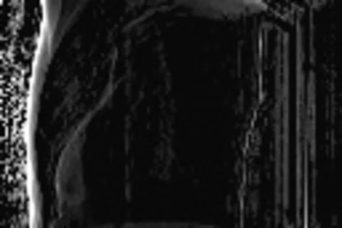 saggital view phantom