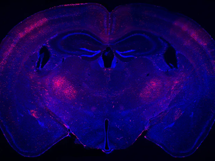 coronal section from a mouse brain labeled with red fluorescence