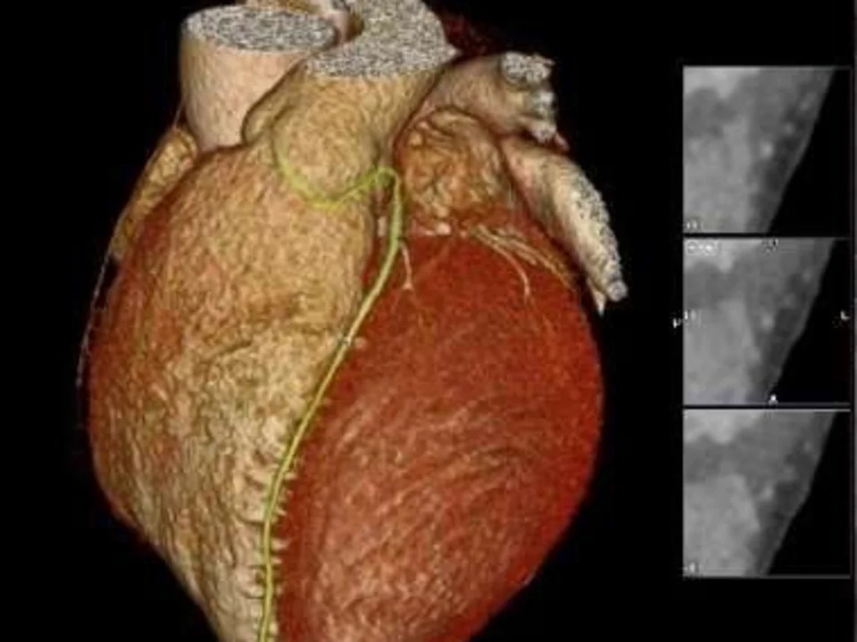 3D image of a heart