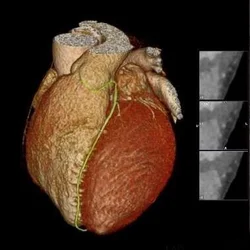 3D image of a heart