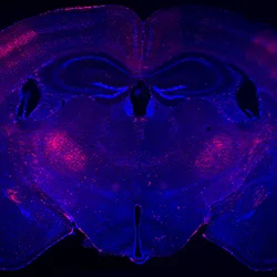 coronal section from a mouse brain labeled with red fluorescence