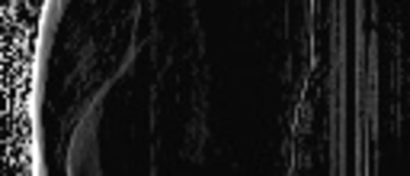 saggital view phantom